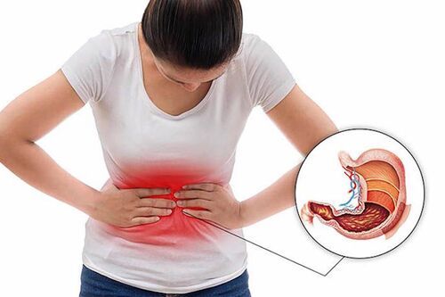 Người mắc bệnh viêm dạ dày nên từ bỏ những thói quen này nếu muốn khỏi bệnh Người mắc bệnh viêm dạ dày nên từ bỏ những thói quen này nếu muốn khỏi bệnh